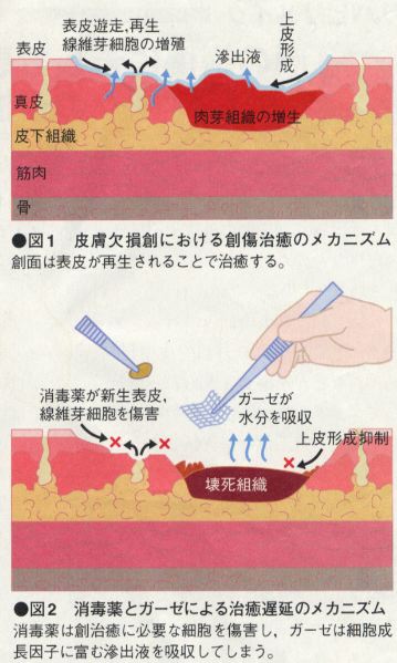 �������������Ɏ������@