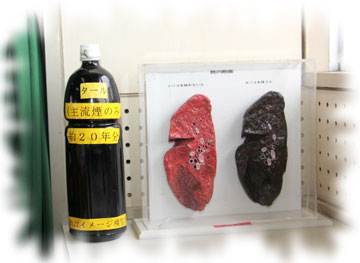 左からタール、健康な肺、喫煙者の肺のモデル 左からタール、健康な肺、喫煙者の肺のモデル